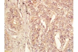 Immunohistochemistry (Paraffin-embedded Sections) (IHC (p)) image for anti-Eukaryotic Translation Initiation Factor 4E Nuclear Import Factor 1 (EIF4ENIF1) (AA 51-150) antibody (ABIN2173808)
