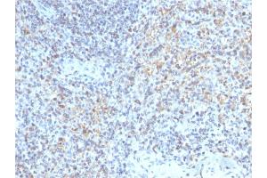 Formalin-fixed, paraffin-embedded human Spleen stained with CD40 Ligand Mouse Monoclonal Antibody (CD40LG/2763). (CD40 Ligand 抗体  (AA 108-261))