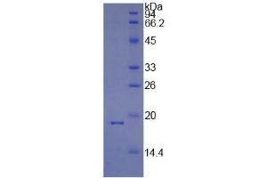 SDS-PAGE (SDS) image for Peptidylprolyl Isomerase A (Cyclophilin A) (PPIA) ELISA Kit (ABIN6574244)
