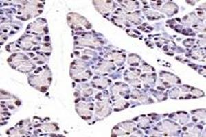 Immunohistochemistry analysis of paraffin-embedded rat pancreas using,NUDT22 (ABIN7074928) at dilution of 1: 7200 (NUDT22 抗体)