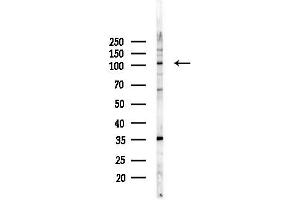 anti-RNA Binding Motif Protein 15 (RBM15) (N-Term) antibody
