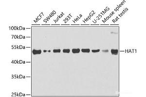 Western blot analysis of extracts of various cell lines using HAT1 Polyclonal Antibody at dilution of 1:1000. (HAT1 抗体)
