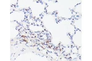 Immunohistochemistry of paraffin-embedded Rat lung using Phospho-MYC(S62) Polyclonal Antibody at dilution of 1:100 (40x lens). (c-MYC 抗体  (pSer62))