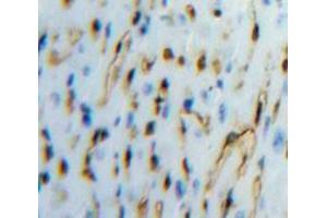 Used in DAB staining on fromalin fixed paraffin-embedded Heart tissue (TFPI 抗体  (AA 29-306))