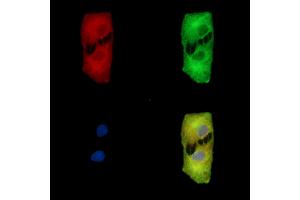 ABIN7095632 and ABIN7099694 staining  cells by IF/ICC. (ETF1 抗体)