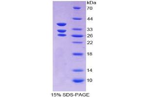 SDS-PAGE analysis of Mouse ICA1 Protein. (ICA1 蛋白)