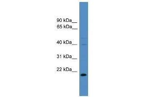 TIMP3 antibody used at 0. (TIMP3 抗体  (N-Term))