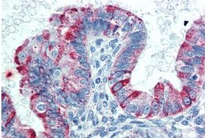 Human Uterus: Formalin-Fixed, Paraffin-Embedded (FFPE) (HVEM 抗体  (AA 38-284))