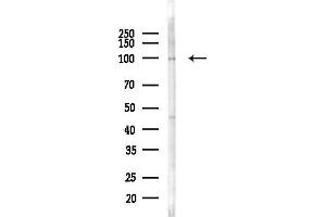 anti-Drebrin 1 (DBN1) (Internal Region) antibody