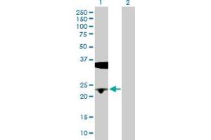 Western Blot analysis of BLVRB expression in transfected 293T cell line by BLVRB MaxPab polyclonal antibody.