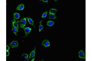 Immunofluorescent analysis of A549 cells using ABIN7163828 at dilution of 1:100 and Alexa Fluor 488-congugated AffiniPure Goat Anti-Rabbit IgG(H+L) (PKD1L3 抗体  (AA 22-194))