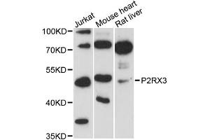 Western blot analysis of extracts of various cell lines, using P2RX3 antibody (ABIN6293509) at 1:3000 dilution. (P2RX3 抗体)