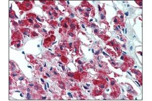 Immunohistochemistry (IHC) image for anti-Interleukin 23, alpha subunit p19 (IL23A) antibody (ABIN614363) (IL23A 抗体)