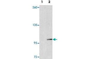 Western blot analysis of EPHA4 (arrow) using EPHA4 polyclonal antibody . (EPH Receptor A4 抗体  (AA 40-70))