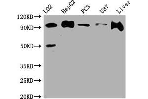 Western Blot Positive WB detected in: L02 whole cell lysate, HepG2 whole cell lysate, PC-3 whole cell lysate, U-87 whole cell lysate, Rat Liver whole cell lysate All lanes: ALIX antibody at 1:1000 Secondary Goat polyclonal to rabbit IgG at 1/50000 dilution Predicted band size: 97, 97, 31 kDa Observed band size: 97 kDa (Recombinant ALIX 抗体)