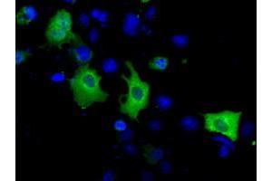 Image no. 7 for anti-Acetyl-CoA Acetyltransferase 2 (ACAT2) antibody (ABIN1496401) (ACAT2 抗体)