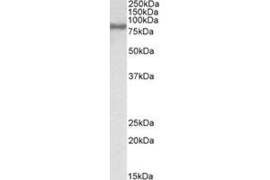 Western Blotting (WB) image for anti-Acyl-CoA Synthetase Long-Chain Family Member 4 (ACSL4) (C-Term) antibody (ABIN2465674) (ACSL4 抗体  (C-Term))