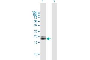 Western Blot analysis of IFNA1 expression in transfected 293T cell line by IFNA1 MaxPab polyclonal antibody. (IFNA1 抗体  (AA 1-189))
