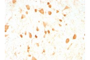 Formalin-fixed, paraffin-embedded Rat Cerebellum stained with Pgp9. (UCHL1 抗体)