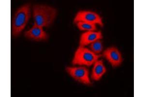 Immunofluorescent analysis of Tyrosine Hydroxylase staining in DLD cells.