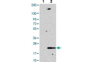 Western blot analysis of Lane 1: Negative control (vector only transfected HEK293T lysate). (ANAPC13 抗体)