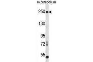 Western blot analysis in mouse cerebellum tissue lysates (35ug/lane) using CD171 / L1CAM Antibody . (L1CAM 抗体  (C-Term))