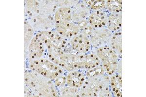 Immunohistochemistry of paraffin-embedded mouse kidney using RPS27A antibody (ABIN7270022) at dilution of 1:100 (40x lens). (RPS27A 抗体  (AA 1-156))