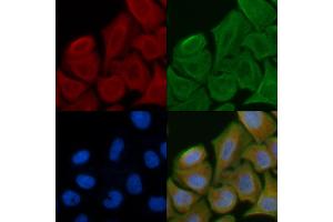 ABIN6258650 and ABIN6275381 staining Hela cells by IF/ICC.