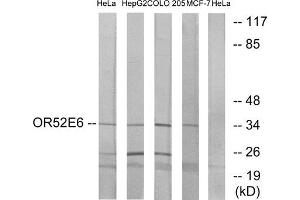 Western blot analysis of extracts from HeLa cells, HepG2 cells, COLO cells and MCF-7 cells, using OR52E6 antibody. (OR52E6 抗体  (C-Term))