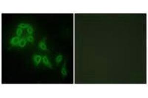 Immunofluorescence analysis of HepG2 cells, using Collagen V α2 antibody. (COL5A2 抗体)