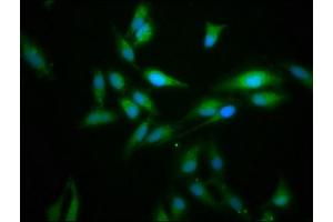 Immunofluorescence staining of Hela cells with ABIN7165598 at 1:166, counter-stained with DAPI. (FLII 抗体  (AA 577-729))