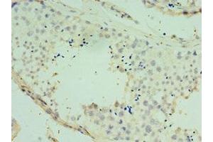 Immunohistochemistry of paraffin-embedded human testis tissue using ABIN7170477 at dilution of 1:100 (SPAG16 抗体  (AA 1-183))
