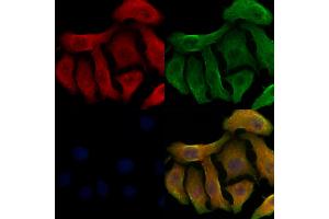 ABIN6263787 and ABIN6278498 staining Hela cells by IF/ICC. (SLC22A6 抗体  (Internal Region))
