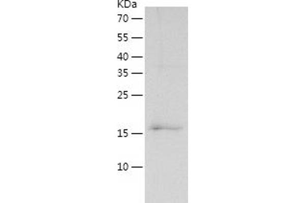 Thymopoietin Protein (TMPO) (AA 2-187) (His tag)