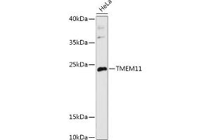 Western blot analysis of extracts of HeLa cells, using TMEM11 antibody (ABIN7270952) at 1:1000 dilution. (TMEM11 抗体  (AA 1-80))