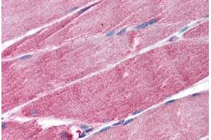 Human Skeletal Muscle (formalin-fixed, paraffin-embedded) stained with TRIM63 antibody ABIN297307 at 1. (TRIM63 抗体  (AA 247-261))