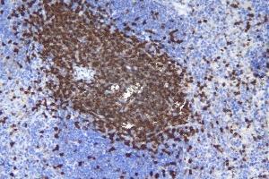 IHC analysis of CD5 using anti-CD5 antibody (ABIN7600839). (CD5 抗体  (AA 24-494))