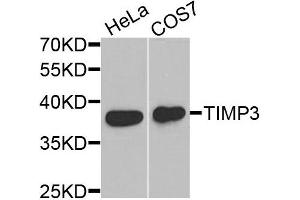 Western blot analysis of extracts of HeLa and COS7 cells, using TIMP3 antibody. (TIMP3 抗体)