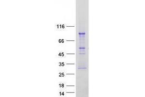 Validation with Western Blot (TRAFD1 Protein (Transcript Variant 1) (Myc-DYKDDDDK Tag))