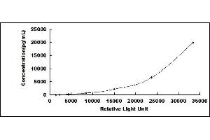 Cartilage Intermediate Layer Protein 2 (Cilp2) CLIA Kit