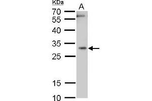 WB Image Heme Oxygenase 1 antibody detects Heme Oxygenase 1 protein by western blot analysis. (HMOX1 抗体)