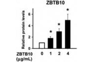 ZBTB10 抗体  (AA 62-77)