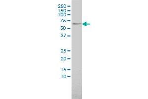 MAP3K7IP1 monoclonal antibody (M01A), clone 2G9 Western Blot analysis of MAP3K7IP1 expression in 293 . (TAB1 抗体  (AA 1-504))