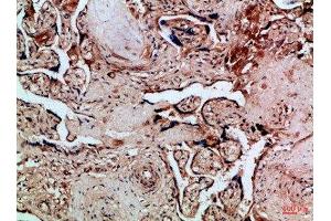 Immunohistochemical analysis of paraffin-embedded Human-placenta, antibody was diluted at 1:100 (FLT4 抗体  (AA 720-760))