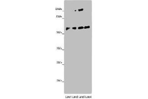 Western blot All lanes: ANGPTL2 antibody at 8 μg/mL Lane 1: Mouse spleen tissue Lane 2: K562 whole cell lysate Lane 3: Hela whole cell lysate Lane 4: A549 whole cell lysate Secondary Goat polyclonal to rabbit IgG at 1/10000 dilution Predicted band size: 58, 23 kDa Observed band size: 58 kDa (ANGPTL2 抗体  (AA 23-493))