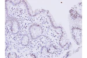 IHC-P Image WRN antibody detects WRN protein at nucleus on human normal colon by immunohistochemical analysis. (RECQL2 抗体  (Center))