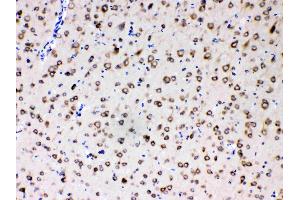MPS1 was detected in paraffin-embedded sections of rat brain tissues using rabbit anti- MPS1 Antigen Affinity purified polyclonal antibody (Catalog # ) at 1 µg/mL.