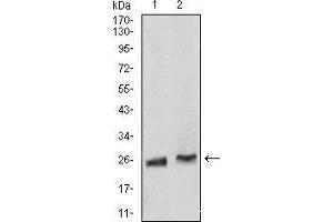 Western Blotting (WB) image for anti-RAB5A, Member RAS Oncogene Family (RAB5A) (AA 1-215) antibody (ABIN5876083) (RAB5 抗体  (AA 1-215))