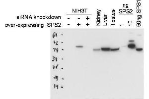 Western blot using  Protein A purified anti-SPS2 antibody shows detection of SPS2 in NIH3T3 cells over-expressing this protein. (SEPHS2 抗体)