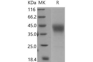 Western Blotting (WB) image for Intercellular Adhesion Molecule 2 (ICAM2) (Active) protein (ABIN7196247) (ICAM2 蛋白)